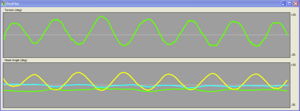 Torsion from Head Roll